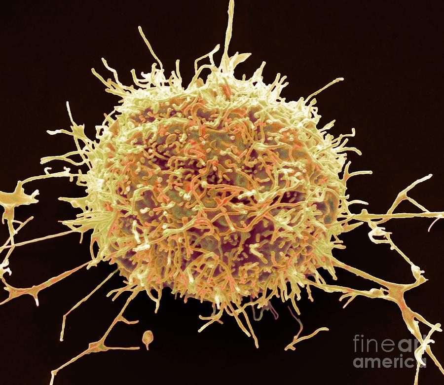 Mesothelioma Cancer Cell #1 Photograph by Steve Gschmeissner/science Photo Library