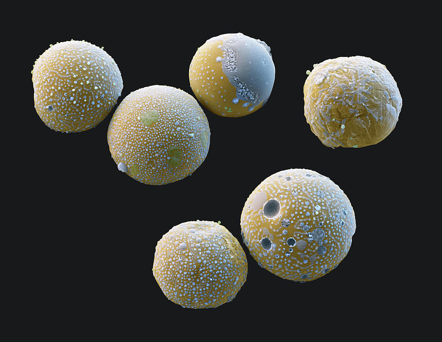 Milk Fat Droplets, Sem #1 Photograph by Eye Of Science