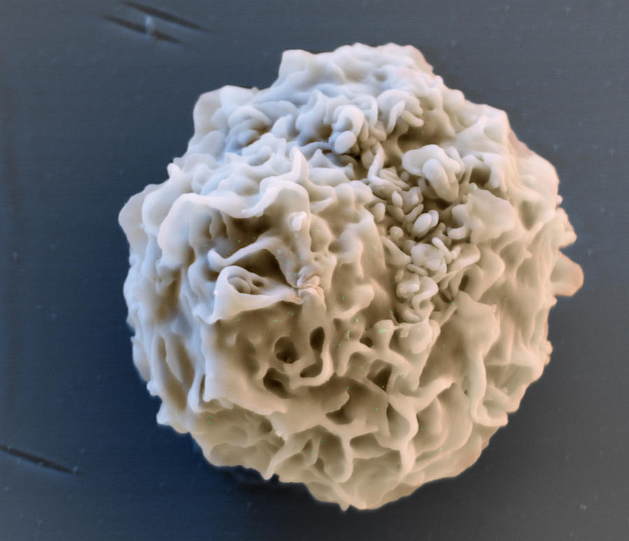 Monocyte White Blood Cell, Sem #1 Photograph by Meckes/ottawa