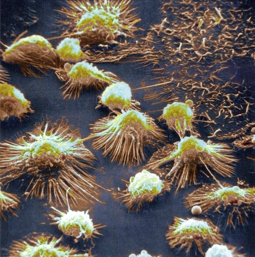Monocytes, Sem #1 Photograph by Biophoto Associates
