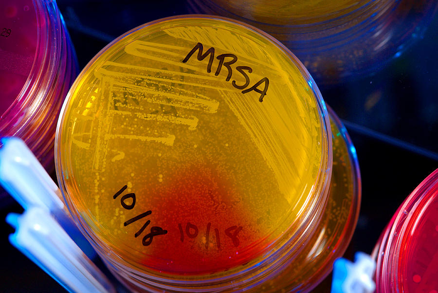 Mrsa Culture #1 Photograph by Science Source