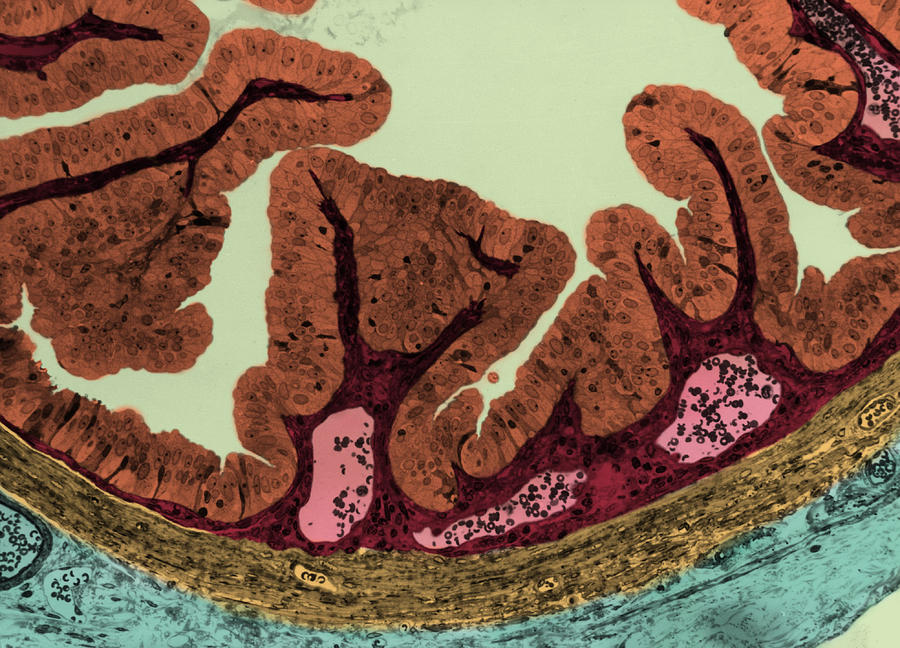 Mucosa From Contracted Gall Bladder, Lm Photograph by Don Fawcett ...