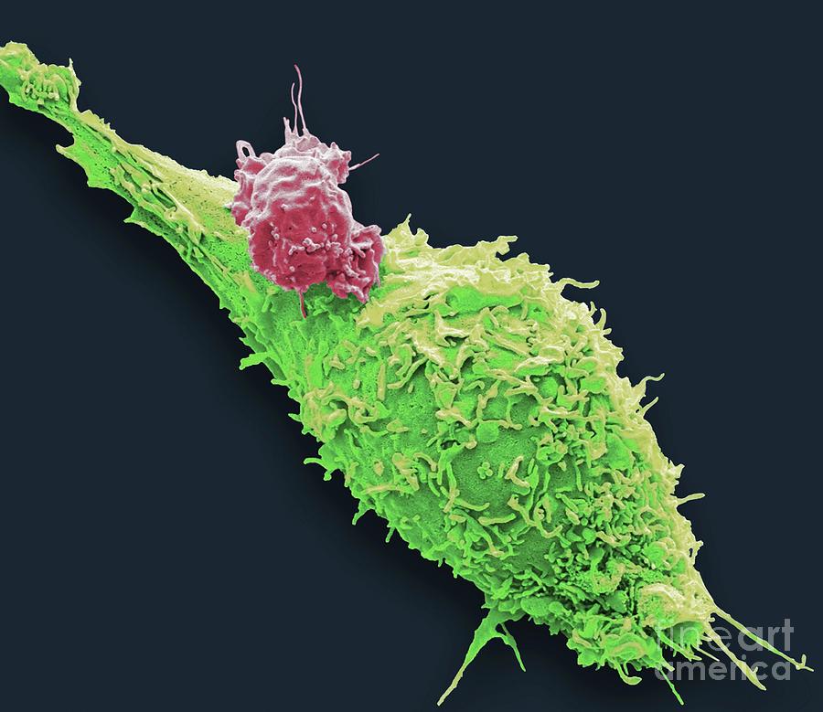 Natural Killer Cell And Cancer Cell Photograph by Steve Gschmeissner ...