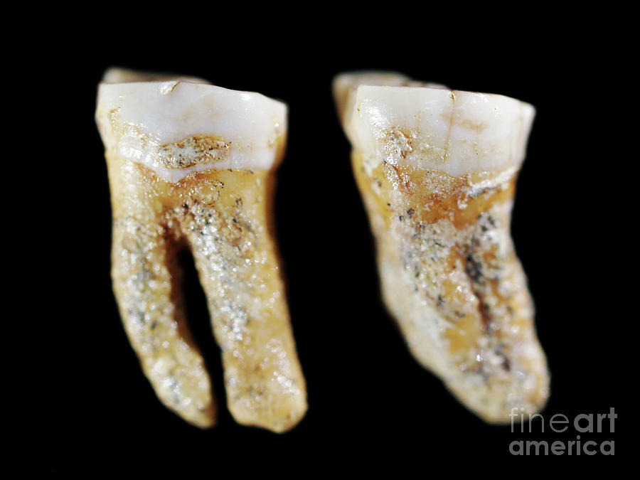 Neanderthal Teeth Photograph By Javier Trueba/msf/science Photo Library ...