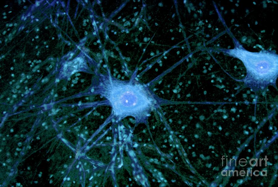 Nerve Cells #1 Photograph by Steve Gschmeissner/science Photo Library