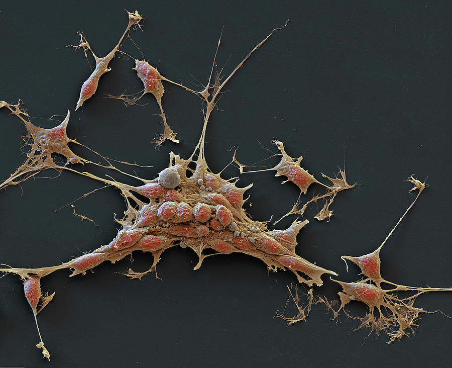 Neuroblastoma Cancer Cells, Sem #1 Photograph by Eye Of Science