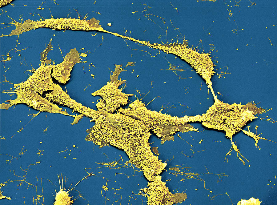 Neuroblastoma Cells #1 Photograph by Meckes/ottawa