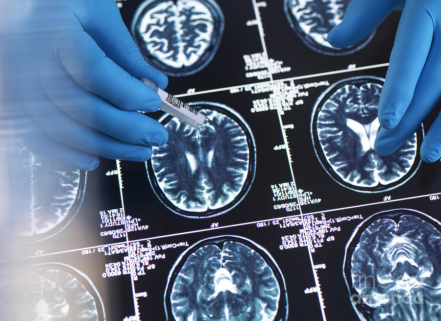 Neurology Clinical Trial #1 Photograph by Tek Image/science Photo Library