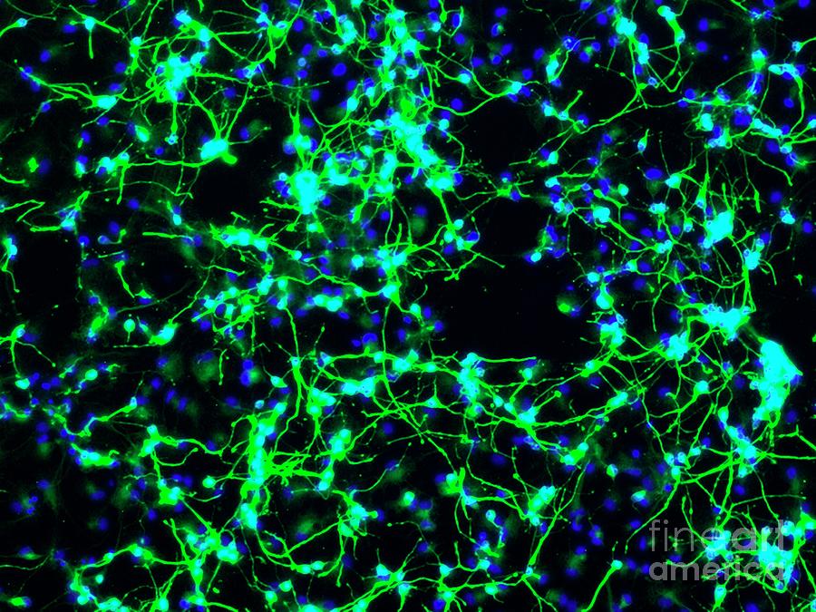 Neurons From Stem Cells Photograph by Daniel Schroen, Cell Applications ...