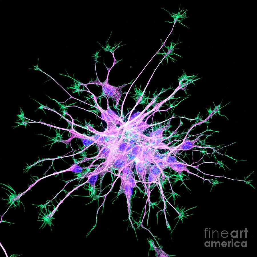 Neurons From Stem Cells #1 Photograph by Dr Torsten Wittmann/science Photo Library
