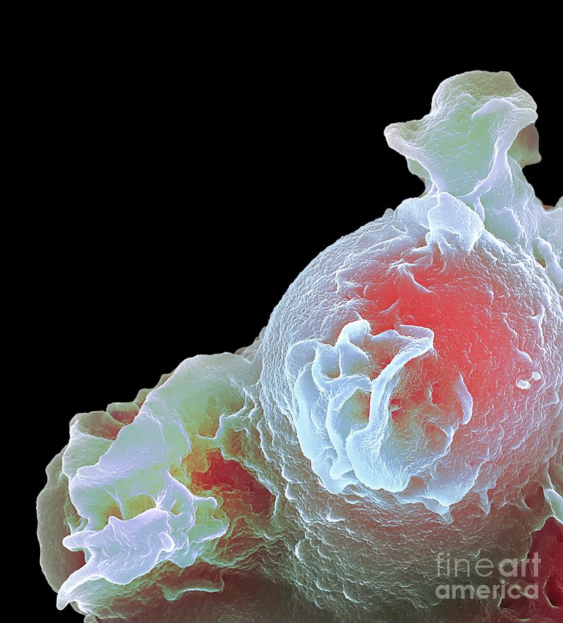 Neutrophil White Blood Cell #1 Photograph by Science Photo Library