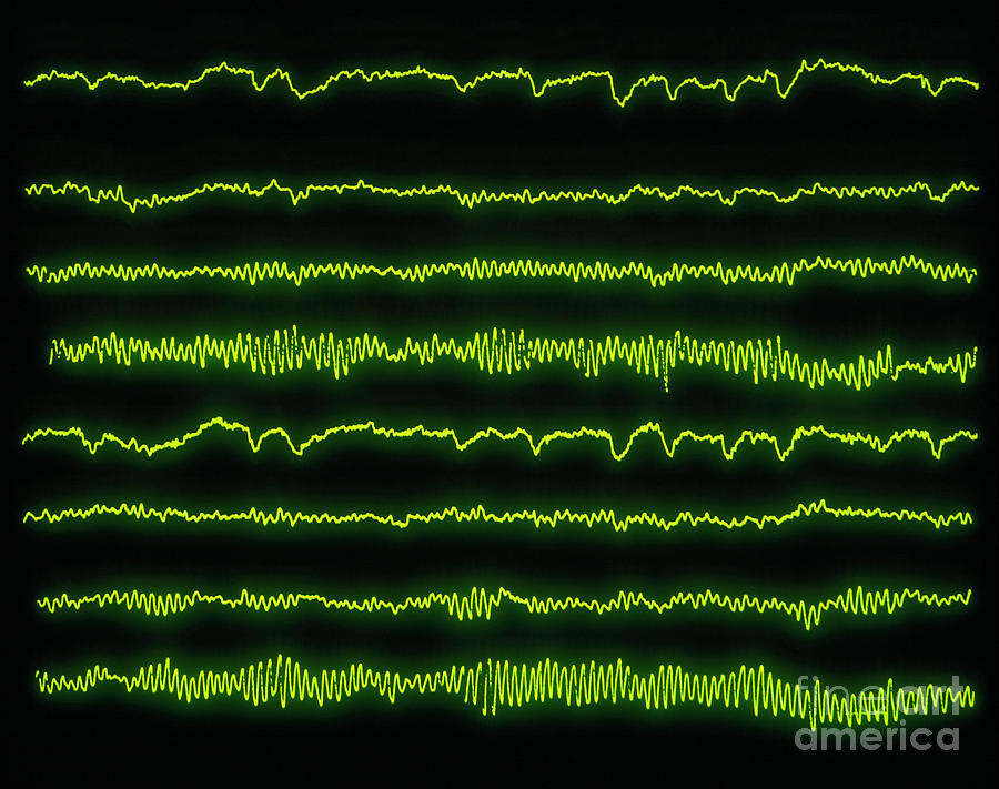 Normal Eeg Pattern (8 Channels) #1 Photograph by Science Photo Library