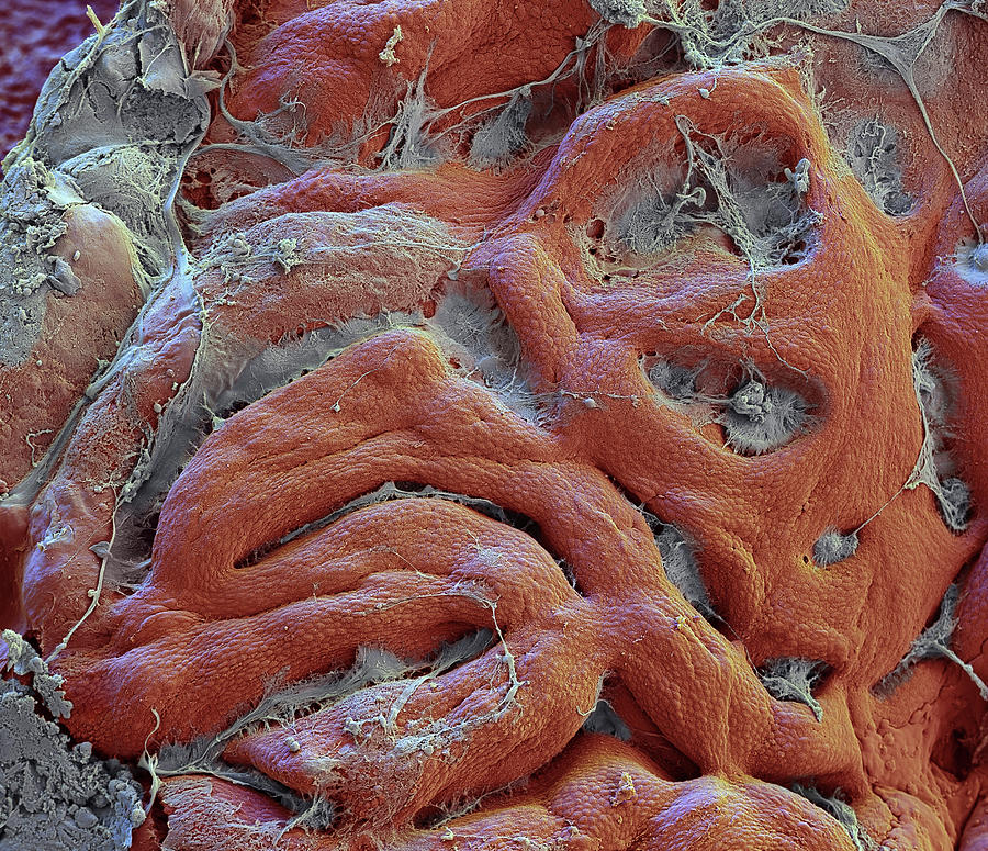 Normal Gastric Mucosa, Sem #1 Photograph by Oliver Meckes