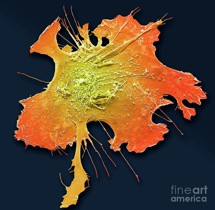 Osteocytes Diagram