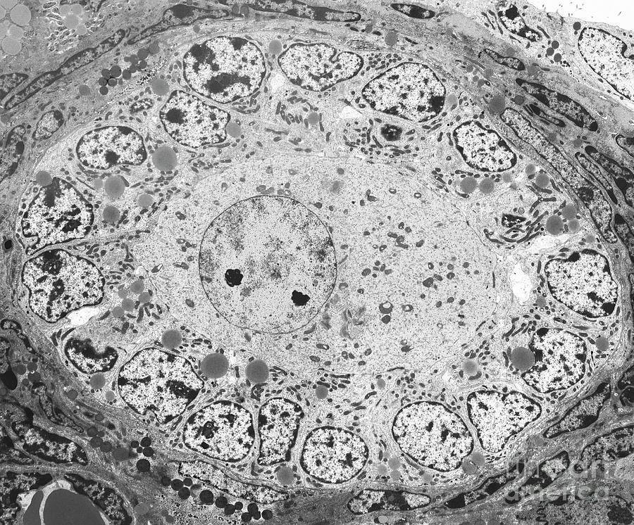 Ovarian Follicle #1 Photograph by Steve Gschmeissner/science Photo Library