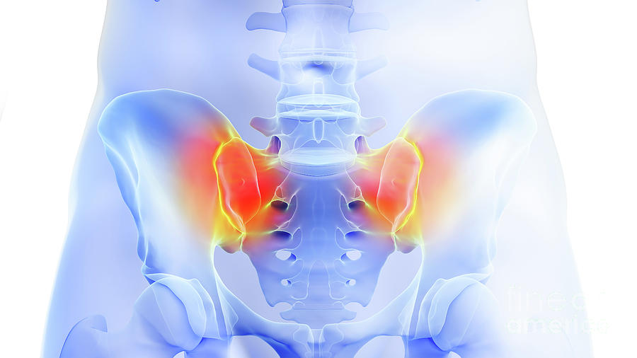 Painful Sacroiliac Joint Photograph by Sebastian Kaulitzki/science ...