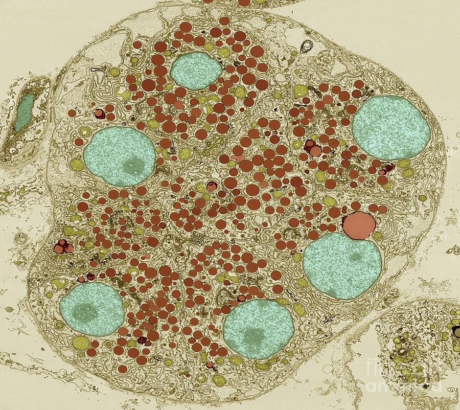 Pancreatic Acinar Cells #1 Photograph by Thomas Deerinck, Ncmir/science Photo Library