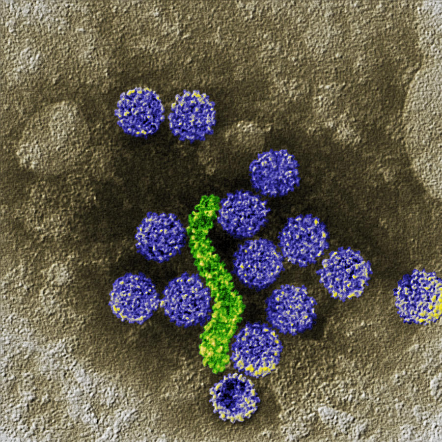 Papillomavirus Virions, Tem #1 Photograph by Meckes/ottawa