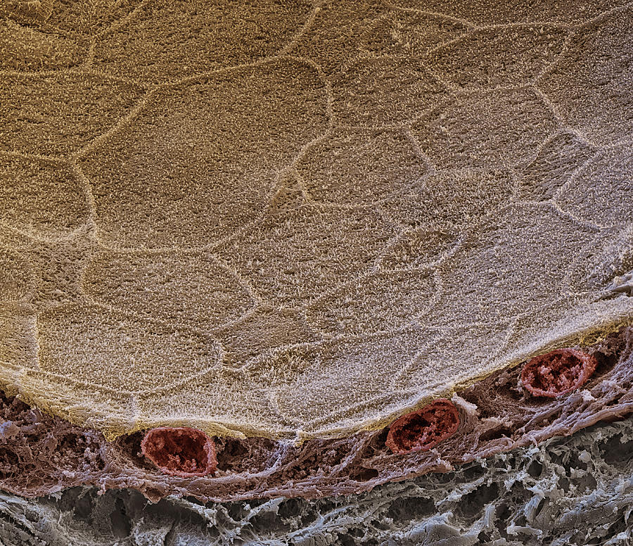 Parotid Gland, Sem Photograph by Oliver Meckes EYE OF SCIENCE - Fine ...