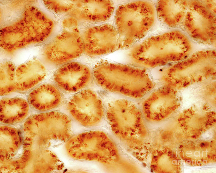 Peroxisomes In Kidney Convoluted Tubule #1 Photograph by Jose Calvo / Science Photo Library