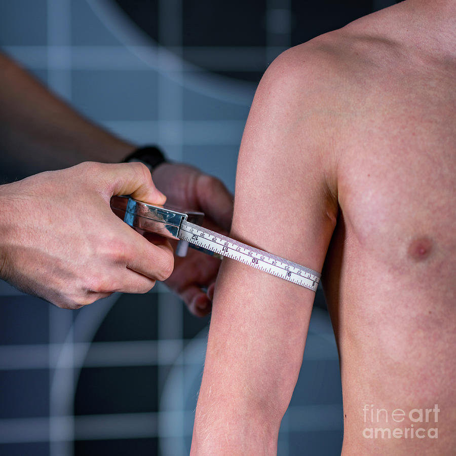 Physical Therapist Measuring Teenage Boys Arm #1 Photograph by Microgen Images/science Photo Library
