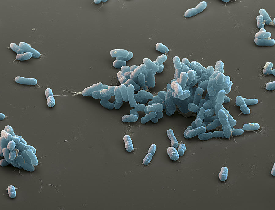Plague Bacteria Yersinia Pestis, Sem #1 Photograph by Meckes/ottawa