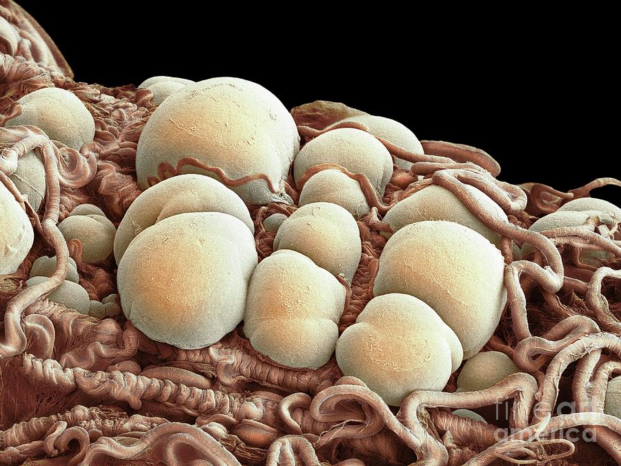 Plasmodium Oocysts In Mosquito Midgut #1 Photograph by Dennis Kunkel Microscopy/science Photo Library