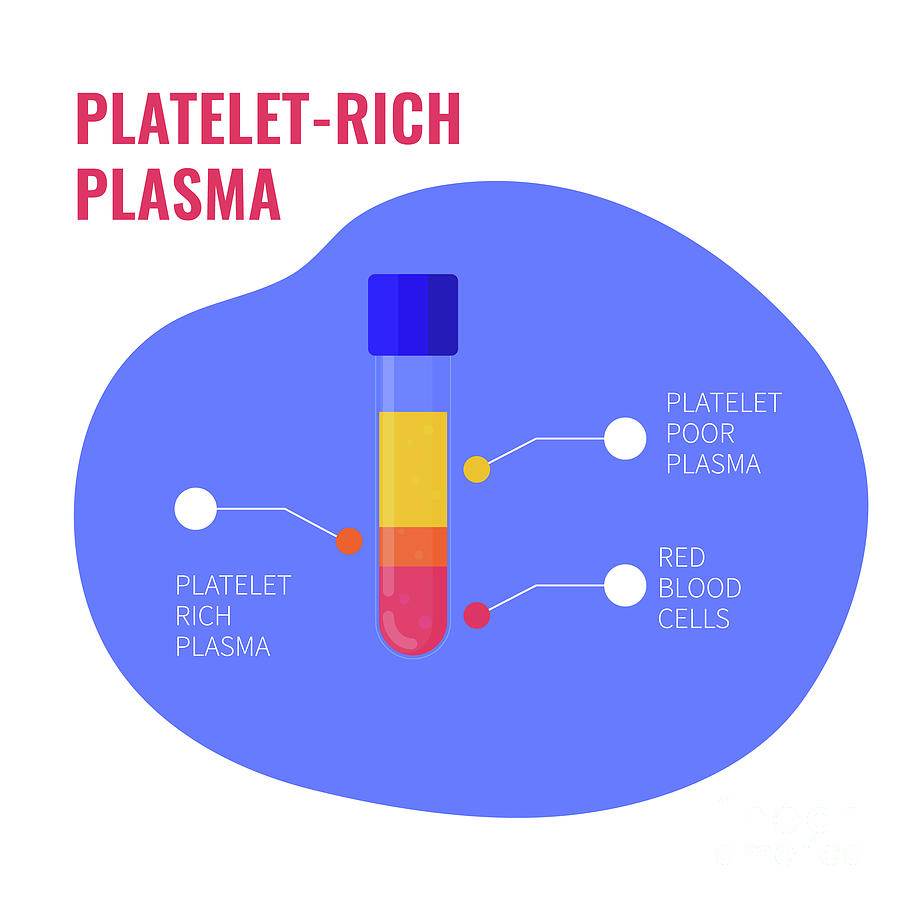 Plasma Photograph - Platelet-rich Plasma Composition #1 by Art4stock/science Photo Library