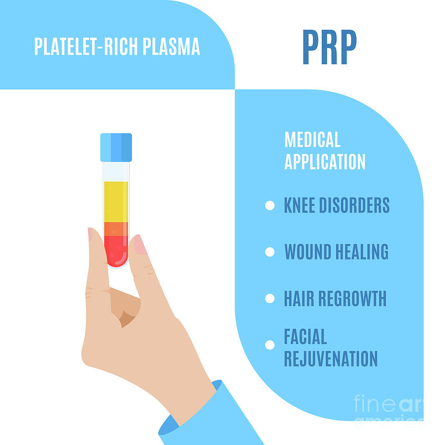 Prp Photograph - Platelet Rich Plasma Medical Use #1 by Art4stock/science Photo Library