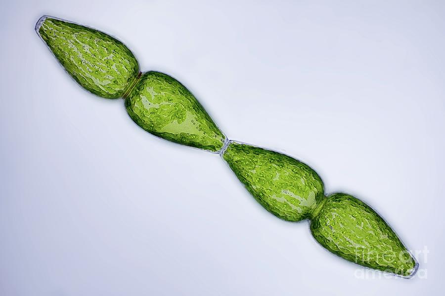 Pleurotaenium Ovatum Desmid Cell Division #1 Photograph by Rogelio Moreno/science Photo Library