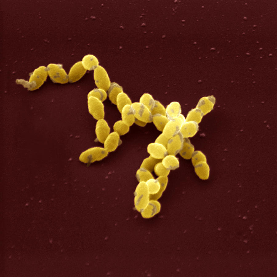 Pneumococcus #1 Photograph by Meckes/ottawa