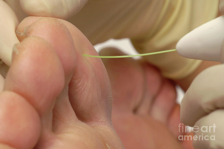 Podiatrist Performs A Foot Sensitivity Test On Her Patient #1 Photograph by Medicimage / Science Photo Library