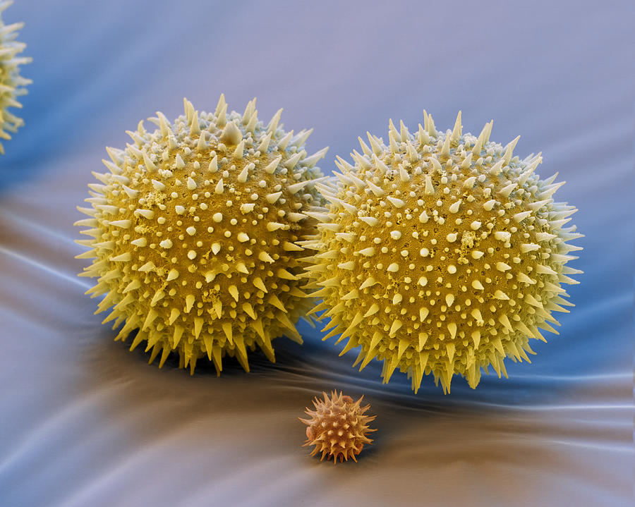 Pollen Grains #1 Photograph by Meckes/ottawa
