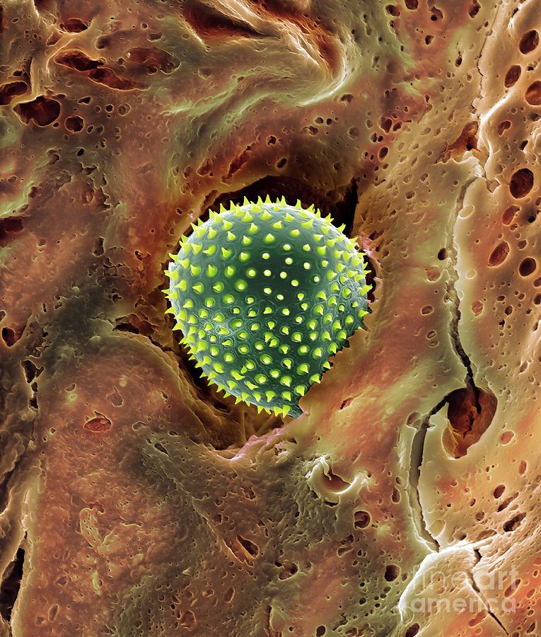 Pollen Trapped In Mucus On Nose Hair #1 Photograph by Dennis Kunkel Microscopy/science Photo Library