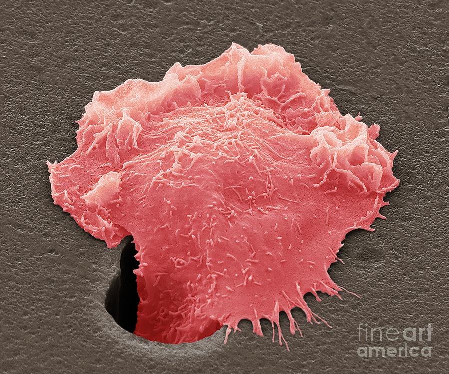 Sarcoma Cancer Cell #1 Photograph by Steve Gschmeissner/science Photo Library