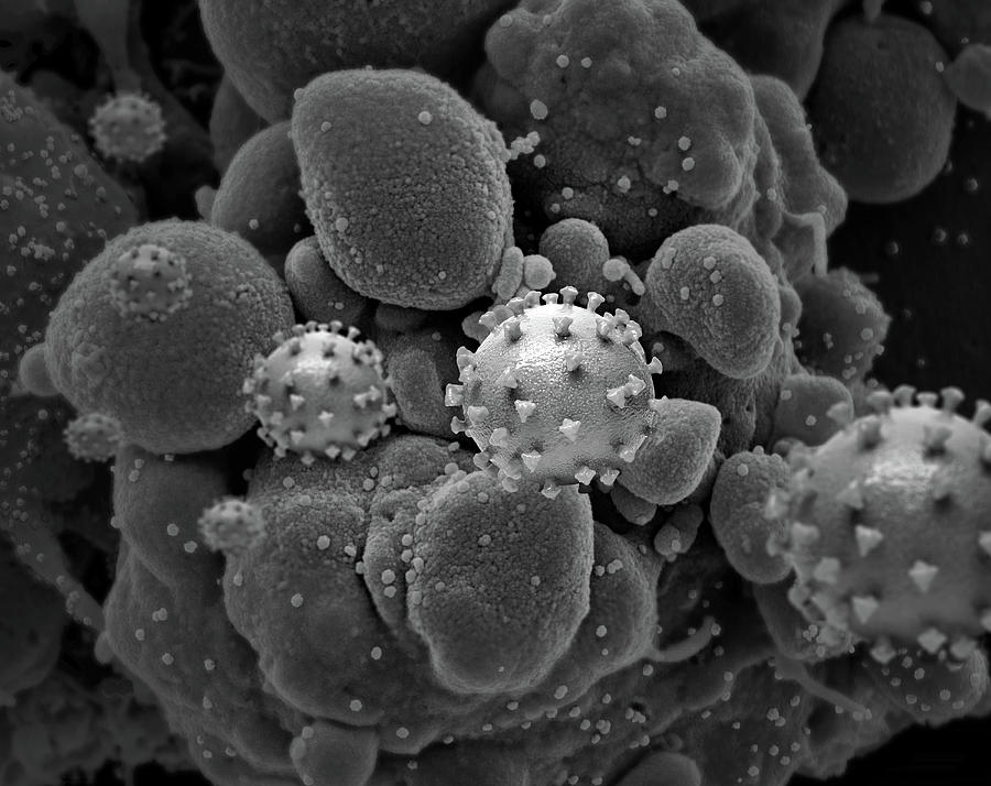 Sars-cov-2, Covid-19 Virus #1 Photograph by Science Source