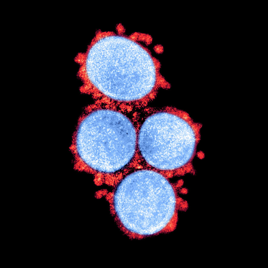 Sars-cov-2, Covid-19 Virus, Tem #1 Photograph by Science Source