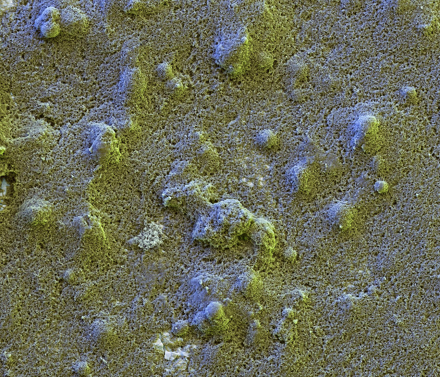 Self-cleaning Paint Sem #1 Photograph by Meckes/ottawa
