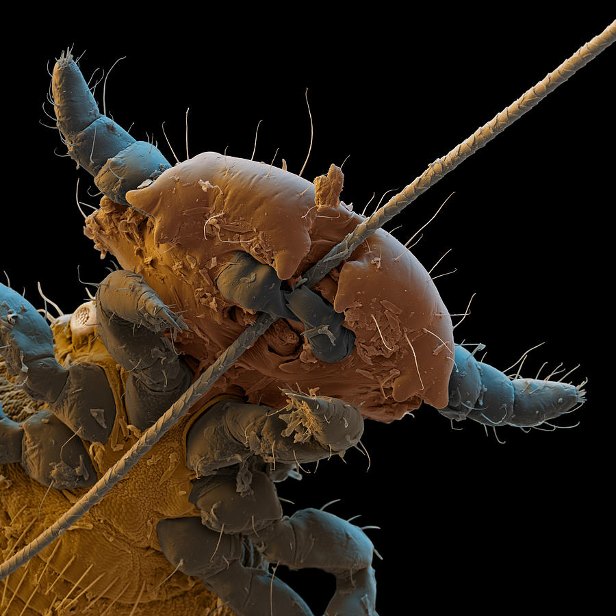 Sem Of Canine Biting Lice Photograph by Meckes/ottawa - Fine Art America