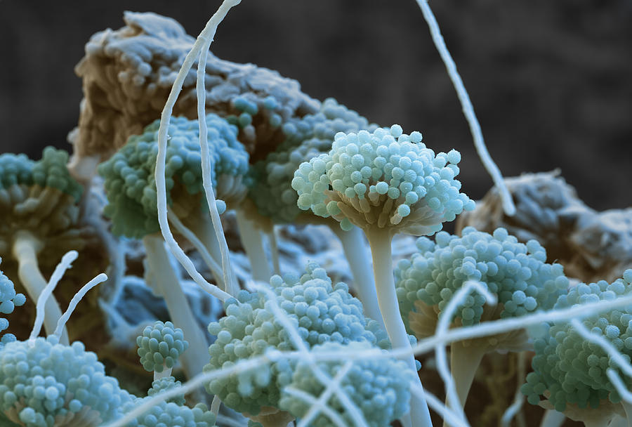 Aspergillus Photograph - Sem Of Emericella Nidulans Fungus #1 by Meckes/ottawa