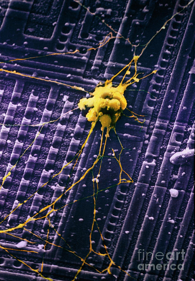 Sem Of Human Nerve Cells On Silicon Chip #1 Photograph by Synaptek/science Photo Library