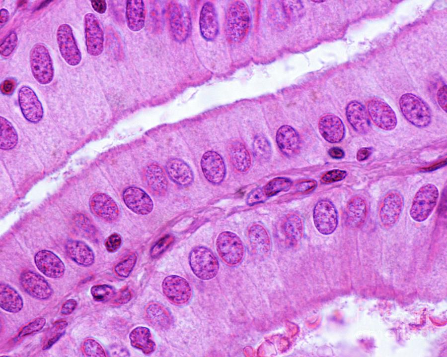 Simple Columnar Epithelium Photograph by Jose Calvo / Science Photo ...