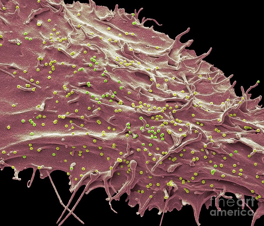 Aids Photograph - Siv Infected Cell #1 by Steve Gschmeissner/science Photo Library