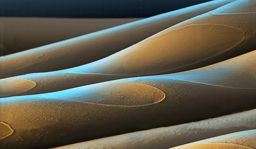 Spandex Sem #1 Photograph by Oliver Meckes EYE OF SCIENCE
