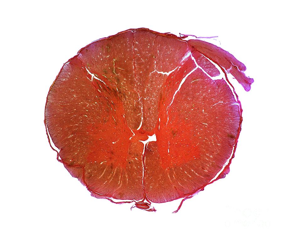 Spinal Cord #1 Photograph by Dr Keith Wheeler/science Photo Library