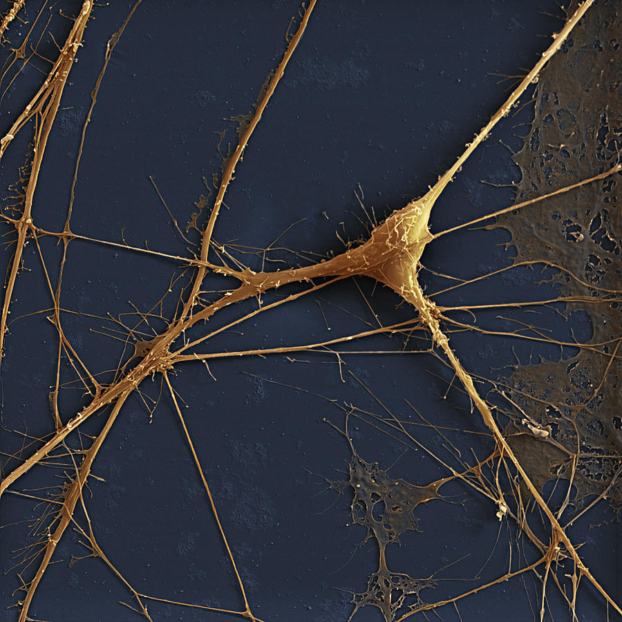 Spinal Ganglion Nerve Fibers Sem #1 Photograph by Meckes/ottawa