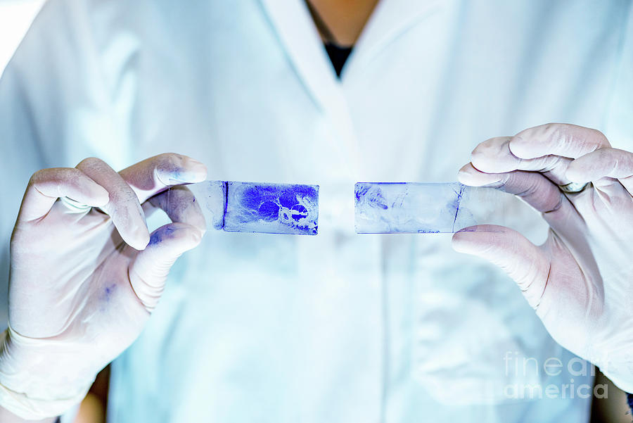 Stained Microscope Slides Photograph by Microgen Images/science Photo