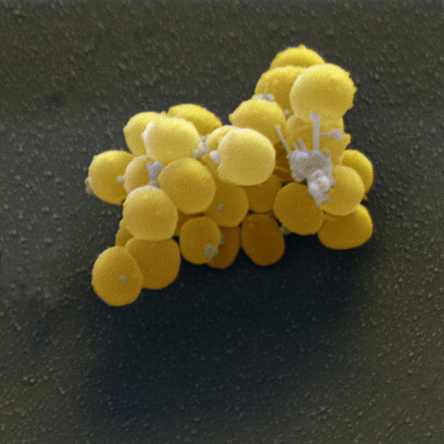 Staphylococcus Aureus Bacteria Photograph By Meckes Ottawa Fine Art