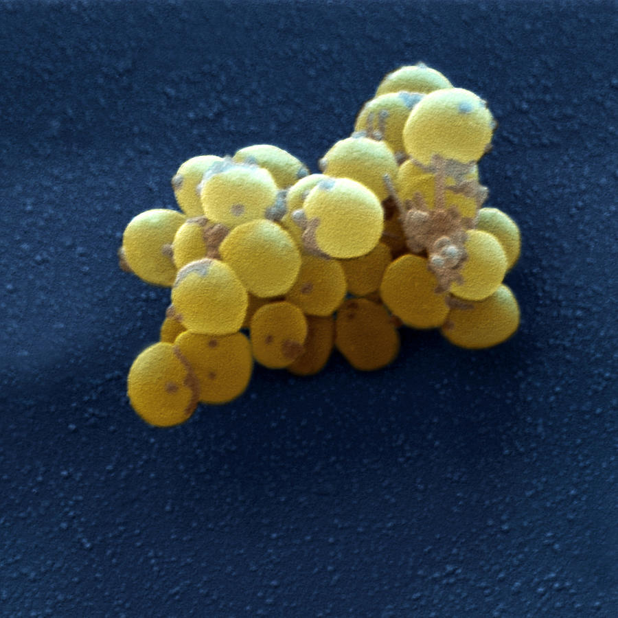 Staphylococcus Aureus #1 Photograph by Meckes/ottawa