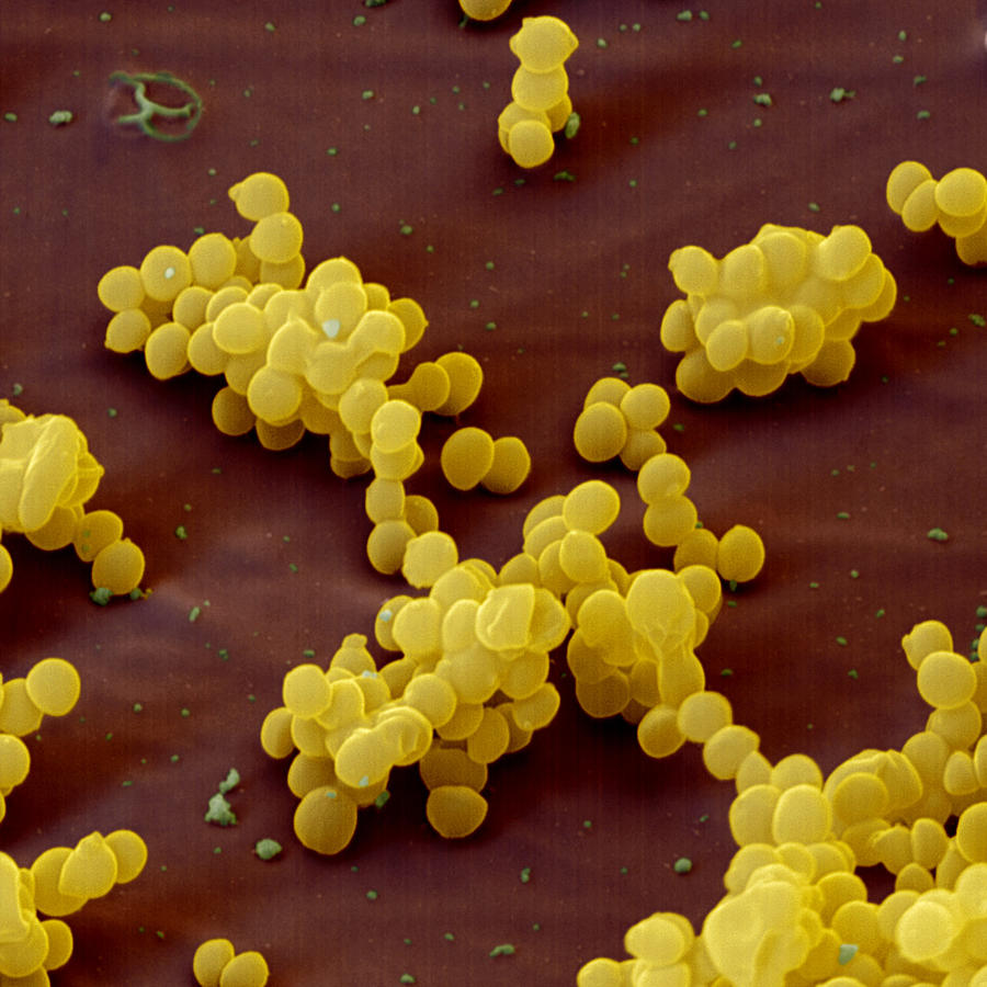 Staphylococcus aureus золотистый стафилококк. S. aureus золотистый стафилококк. Золотушный стафилококк. Стафилококк ауреус микробиология. Стрептококк ауреус.